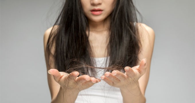 可恢复80%头发生长，创新口服药国内报上市