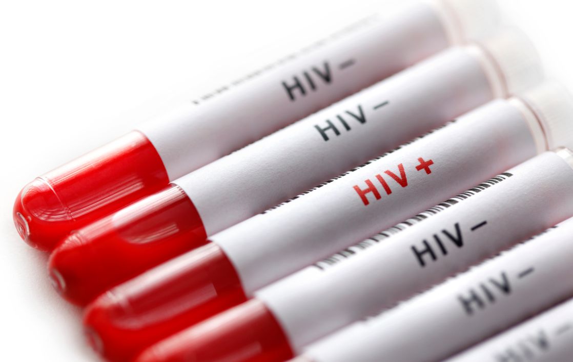 艾滋病基因疗法首例人体试验启动，有望实现“一次治疗、终身治愈”