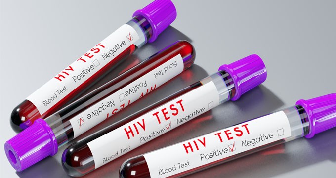 Nature：全球第3位艾滋病治愈者出现