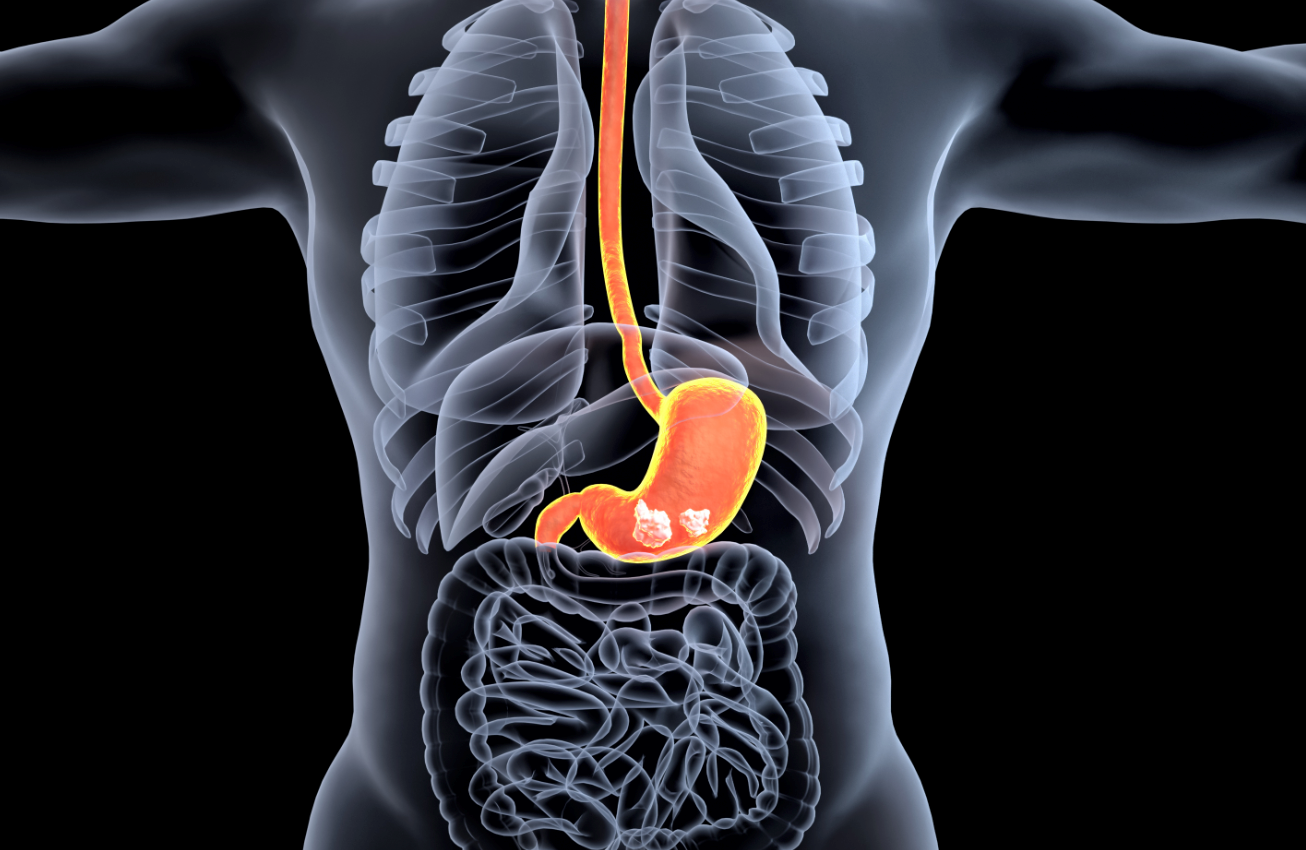 市场潜力再扩容  基石药业潜在同类最优择捷美第四项新适应症上市申请获受理