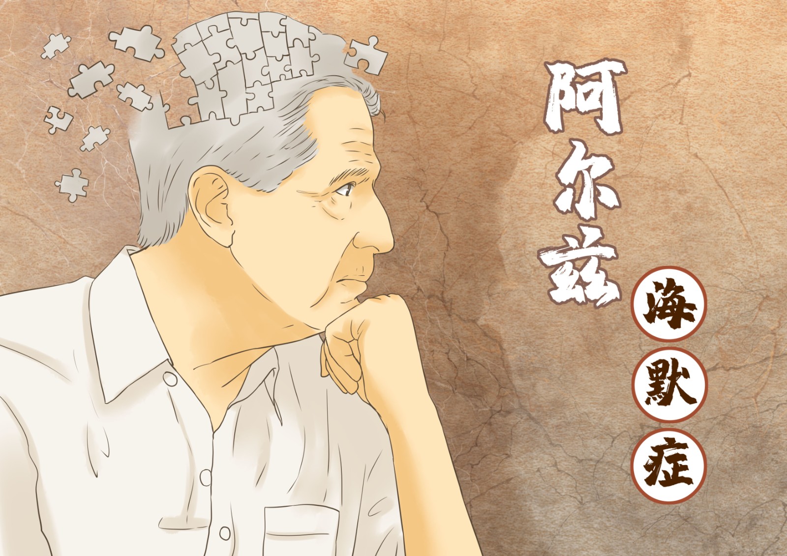 礼来又一款阿尔茨海默症抗体疗法拟纳入突破性治疗品种