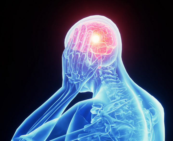 首款偏头痛口服薄膜疗法获批