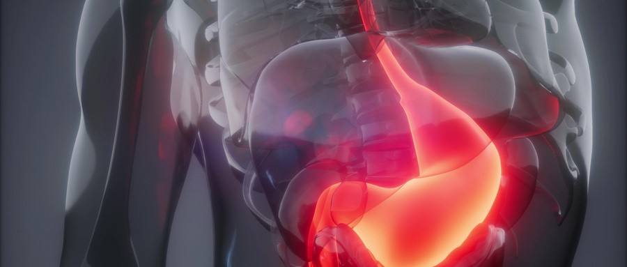 基石药业泰吉华（阿伐替尼片）治疗晚期胃肠道间质瘤最新研究数据亮相2023年ASCO年会