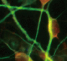 iPSC 生物制造平台瑞臻再生医学完成近亿元Pre-A轮融资