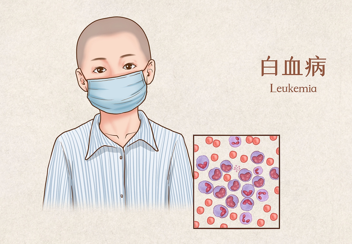 施维雅收购Bionova Pharmaceuticals急性白血病精准疗法BN104