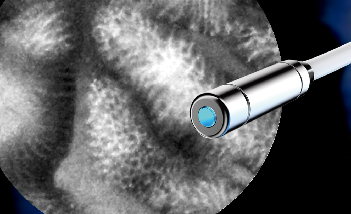超亿元融资落地!精微视达引领国产高端内镜冲刺全球精准诊疗前沿
