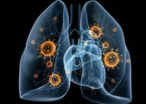 ESMO-IO | ORR达41.7%！君赛生物GC101 TIL治疗晚期后线非小细胞肺癌I期数据首次公布