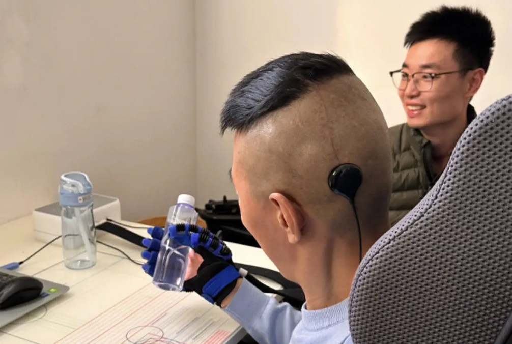 全国已发布脑机接口医疗服务价格统计