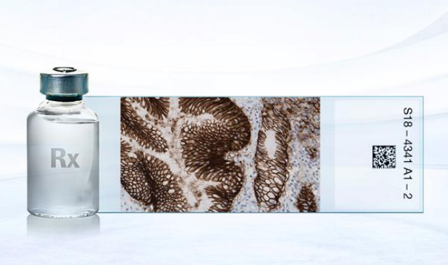 中国首个！威络益伴随诊断试剂(CLDN18) 重磅获批