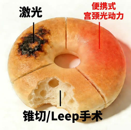 全球首创便携式宫颈无创光动力治疗药物希维她®在华获批