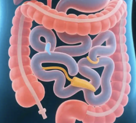 礼来安妥来利®和安妥来®（米吉珠单抗）在华正式上市