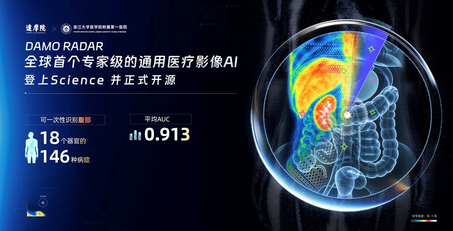 全球首个专家级通用医疗影像模型，一次识别146种病症