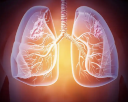 英飞凡联合安泰适一线治疗广泛期小细胞肺癌 Ⅲ期临床试验结果发布